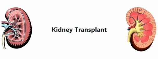 kidney transplant